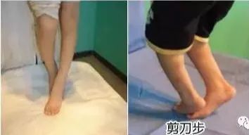 髖關節訓練器_髖關節訓練器的適應癥_髖關節訓練椅