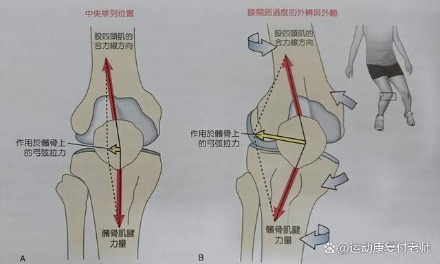 股四頭肌訓練椅子_股四頭肌訓練椅_股四頭肌訓練椅使用方法
